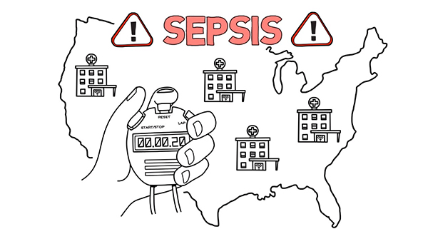 This Sepsis Alliance informational video helps explain the common symptoms patients experience after surviving sepsis